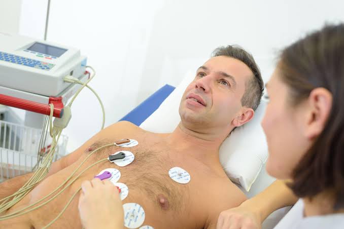 ECG